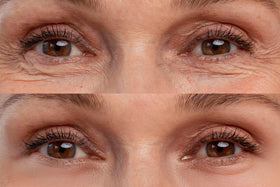 Reduces Trans-epidermal Water Loss and Boosts Skin Hydration in 8-12 weeks